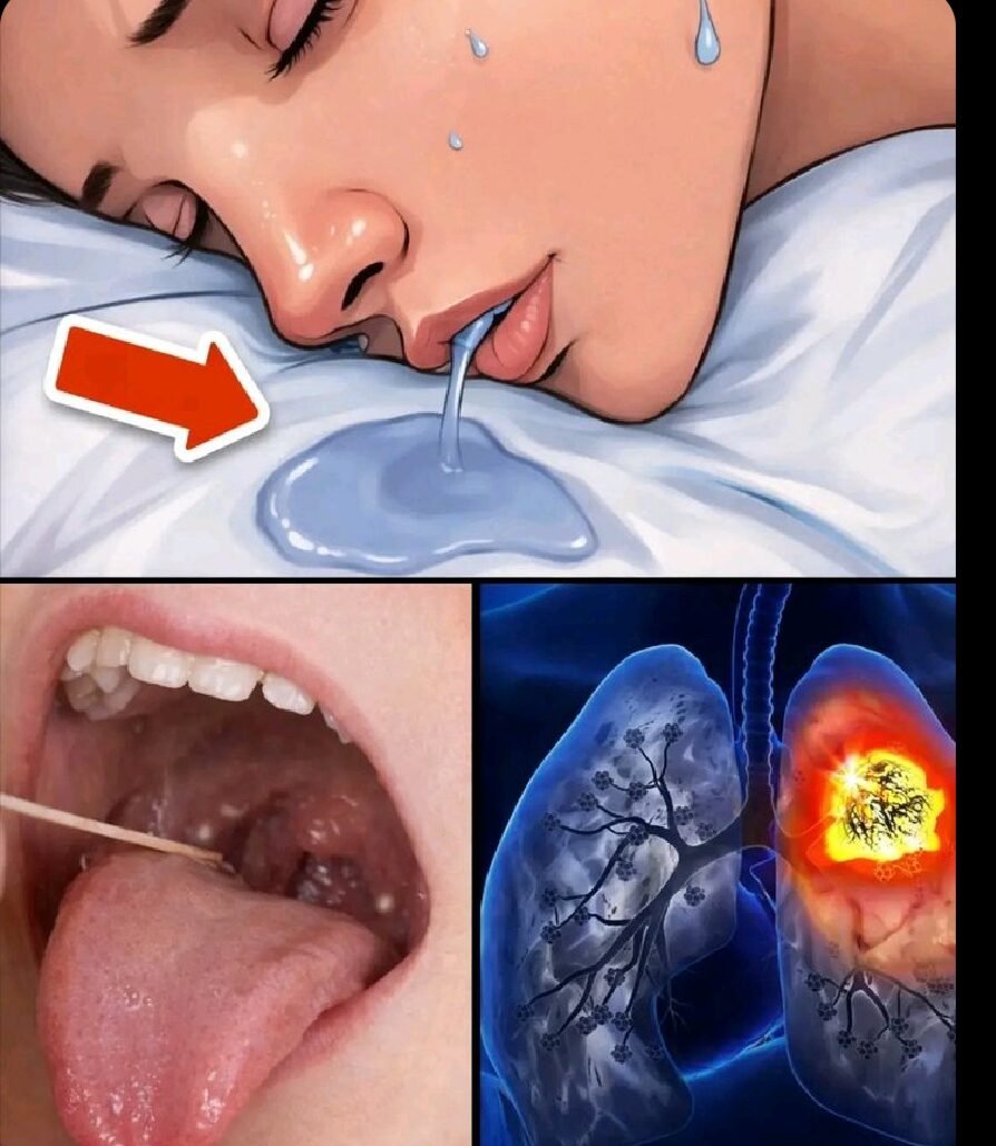 If you drool while sleeping, you should get checked for these 8 conditions
